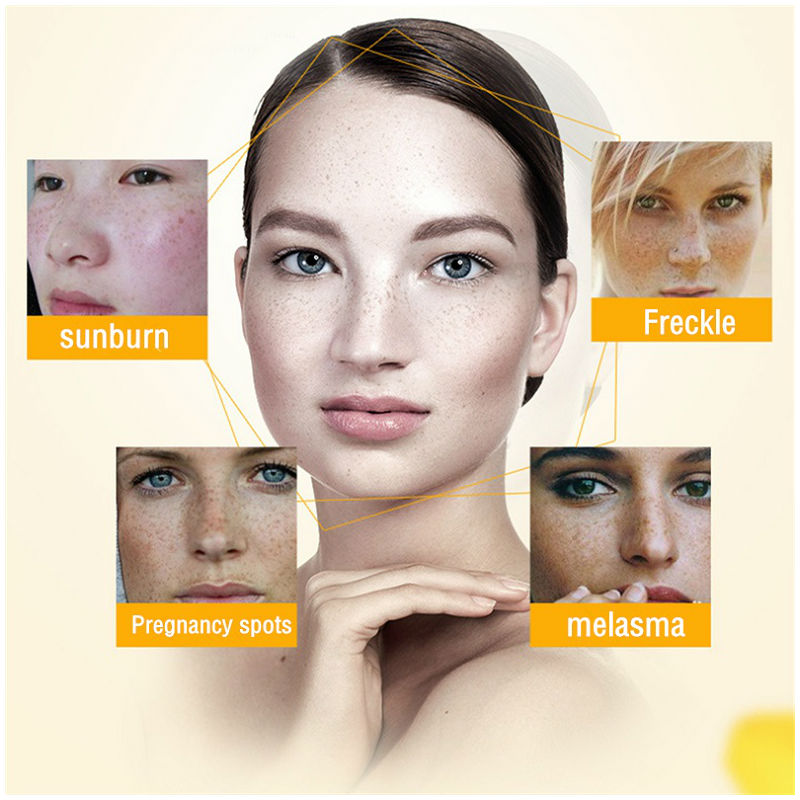 Dimollaure-Crème blanchissante - Retinol Cream avis et prix