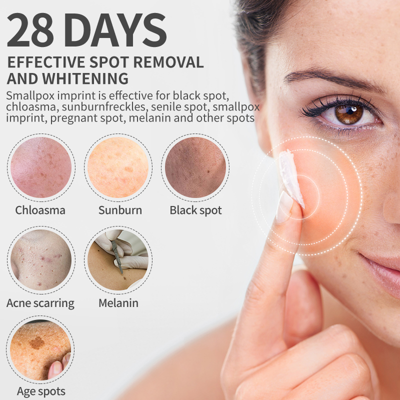 Dimollaure-Crème blanchissante - Retinol Cream avis et prix